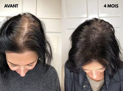 Rootavéa Complexe Densité